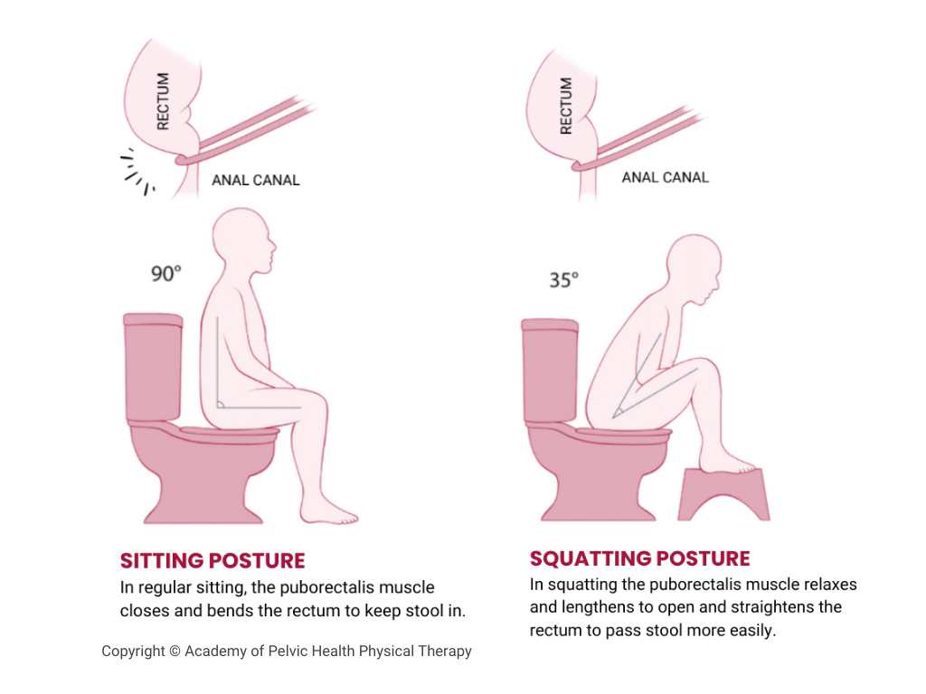 Correct toilet posture can protect your pelvic floor